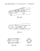 SPLINT COMPOSITION AND METHOD FOR USING SAME diagram and image