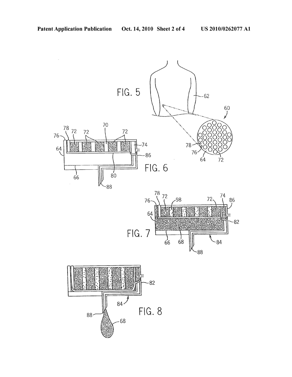 Micro-Fluidic Device For Drug Delivery - diagram, schematic, and image 03