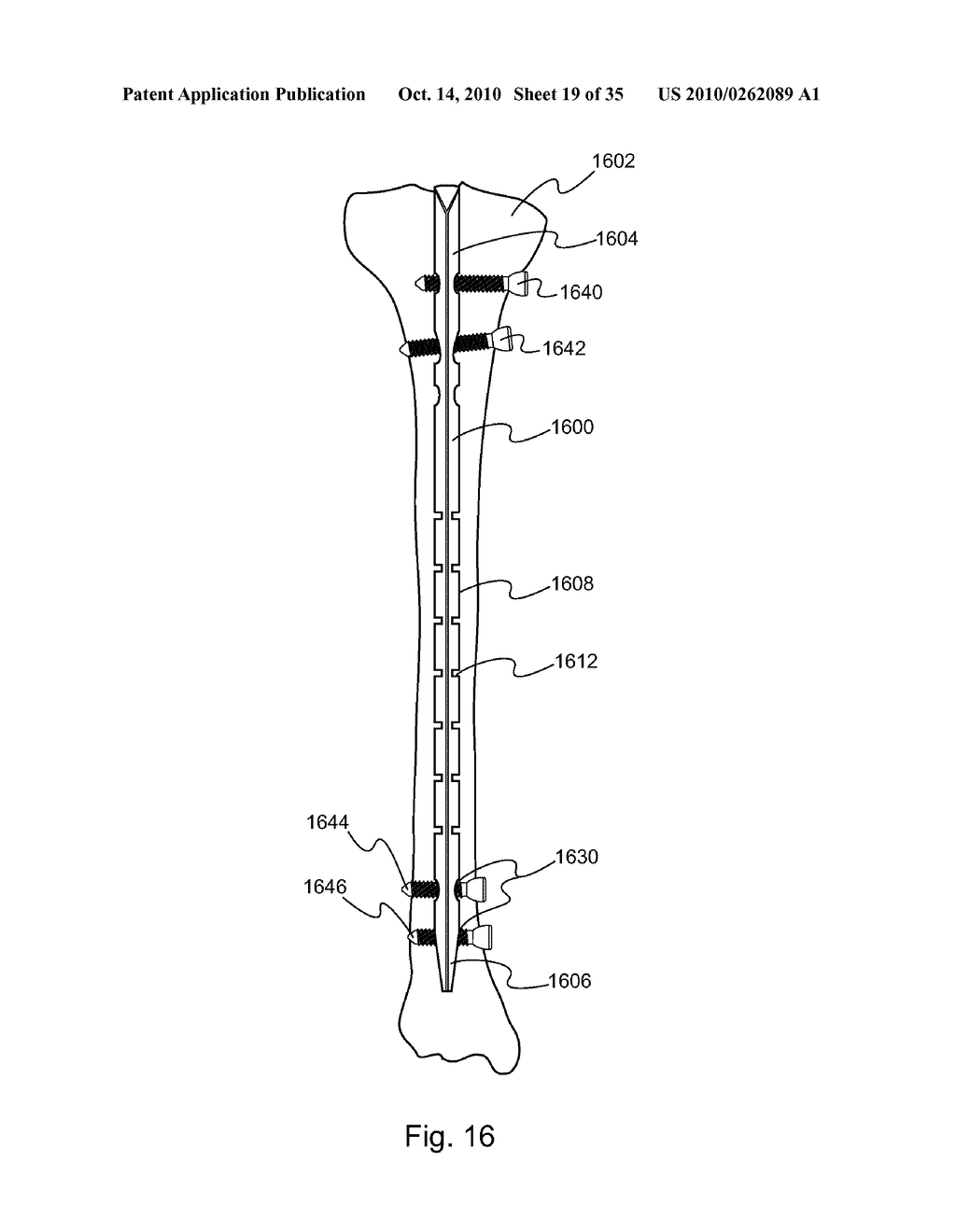 METHOD AND DEVICE FOR DELIVERING MEDICINE TO BONE - diagram, schematic, and image 20