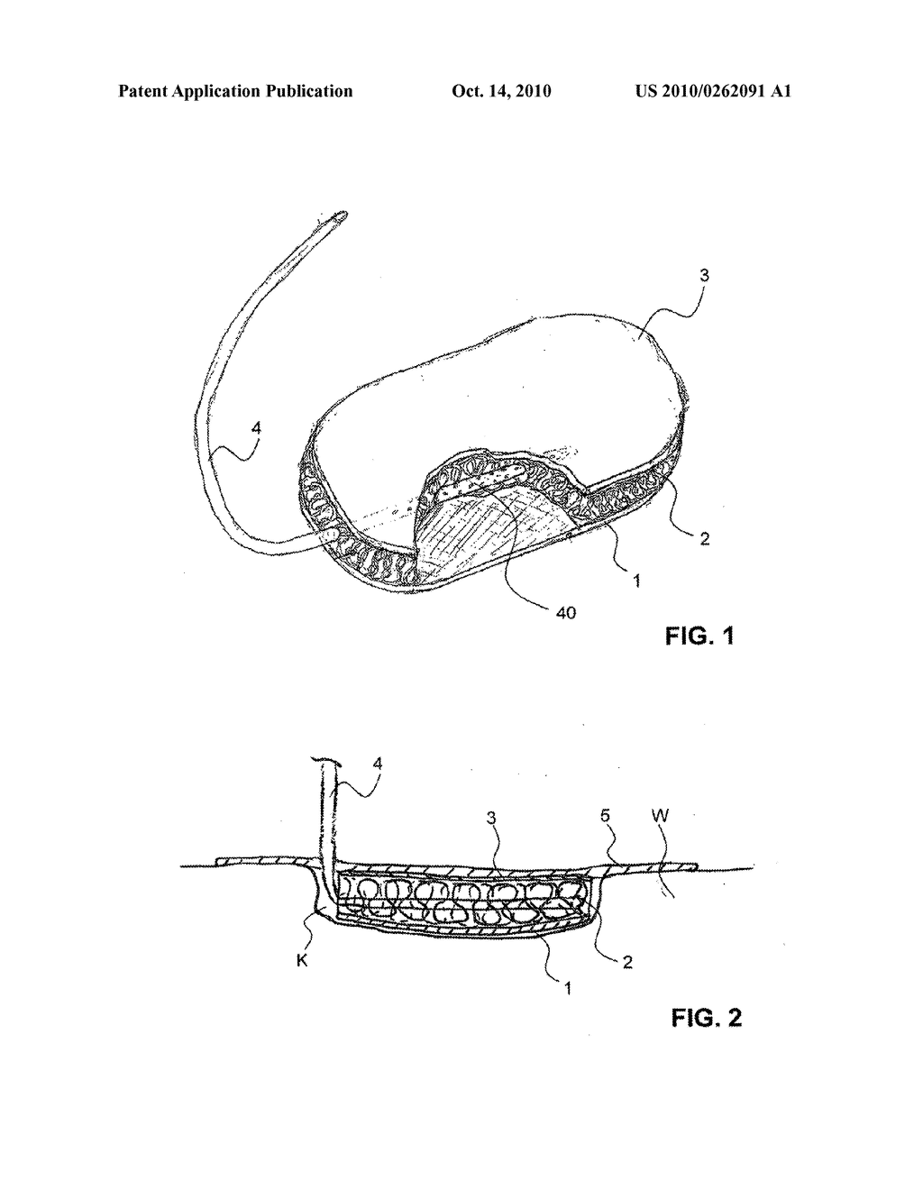 WOUND DRAINAGE DRESSING - diagram, schematic, and image 02