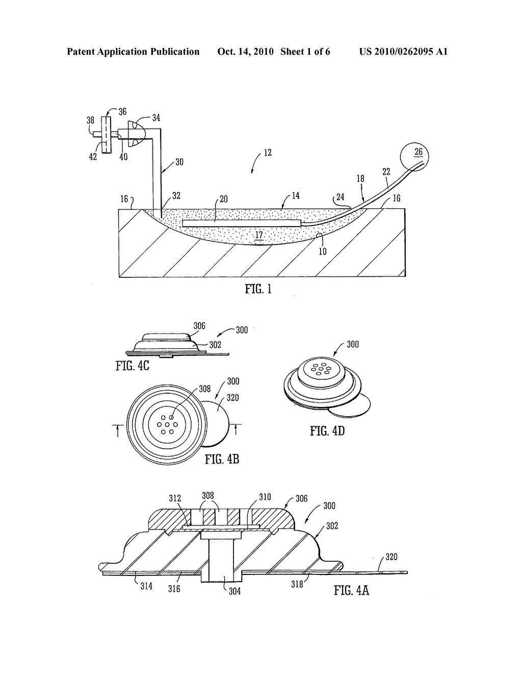 APPARATUS FOR TOPICAL NEGATIVE PRESSURE THERAPY - diagram, schematic, and image 02