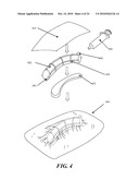 METHODS AND DEVICES FOR APPLYING CLOSED INCISION NEGATIVE PRESSURE WOUND THERAPY diagram and image