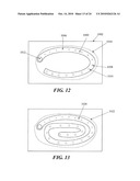 METHODS AND DEVICES FOR APPLYING CLOSED INCISION NEGATIVE PRESSURE WOUND THERAPY diagram and image