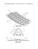 METHODS AND DEVICES FOR APPLYING CLOSED INCISION NEGATIVE PRESSURE WOUND THERAPY diagram and image