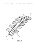 METHODS AND DEVICES FOR APPLYING CLOSED INCISION NEGATIVE PRESSURE WOUND THERAPY diagram and image