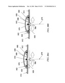 METHODS AND DEVICES FOR APPLYING CLOSED INCISION NEGATIVE PRESSURE WOUND THERAPY diagram and image