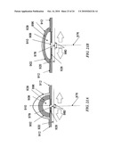 METHODS AND DEVICES FOR APPLYING CLOSED INCISION NEGATIVE PRESSURE WOUND THERAPY diagram and image