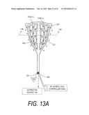 MEDICAL SYSTEMS AND METHODS FOR ABLATING AND ABSORBING TISSUE diagram and image