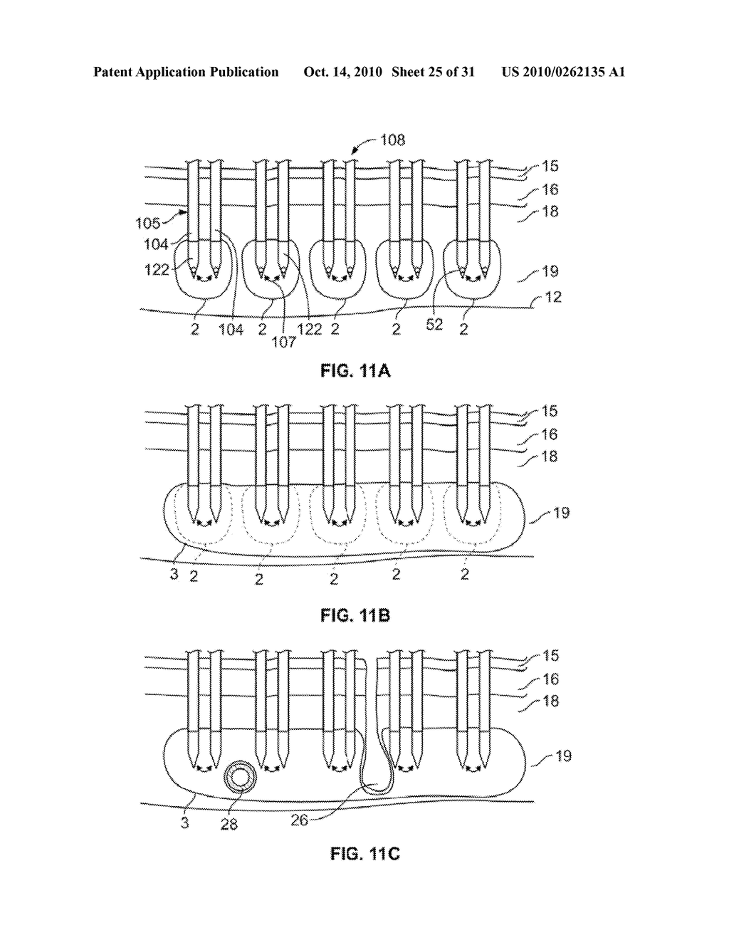 CONTROLLED DELIVERY OF THERAPEUTIC ENERGY TO TISSUE - diagram, schematic, and image 26