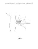 Interfacing Media Manipulation with Non-Ablation Radiofrequency Energy System and Method diagram and image