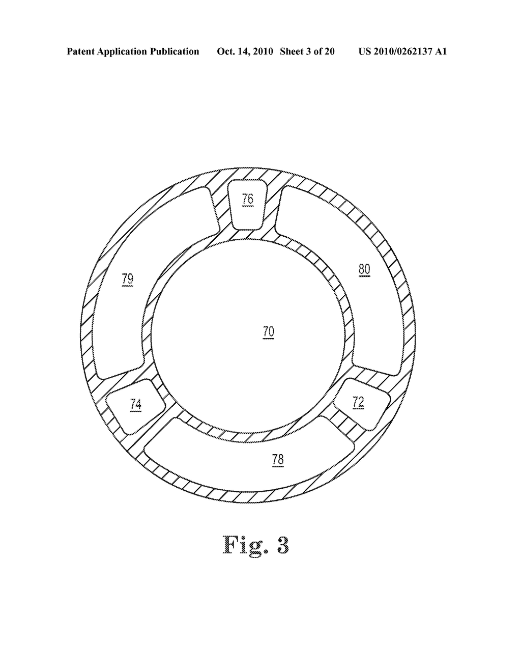 COOLED ANTENNA FOR DEVICE INSERTABLE INTO A BODY - diagram, schematic, and image 04