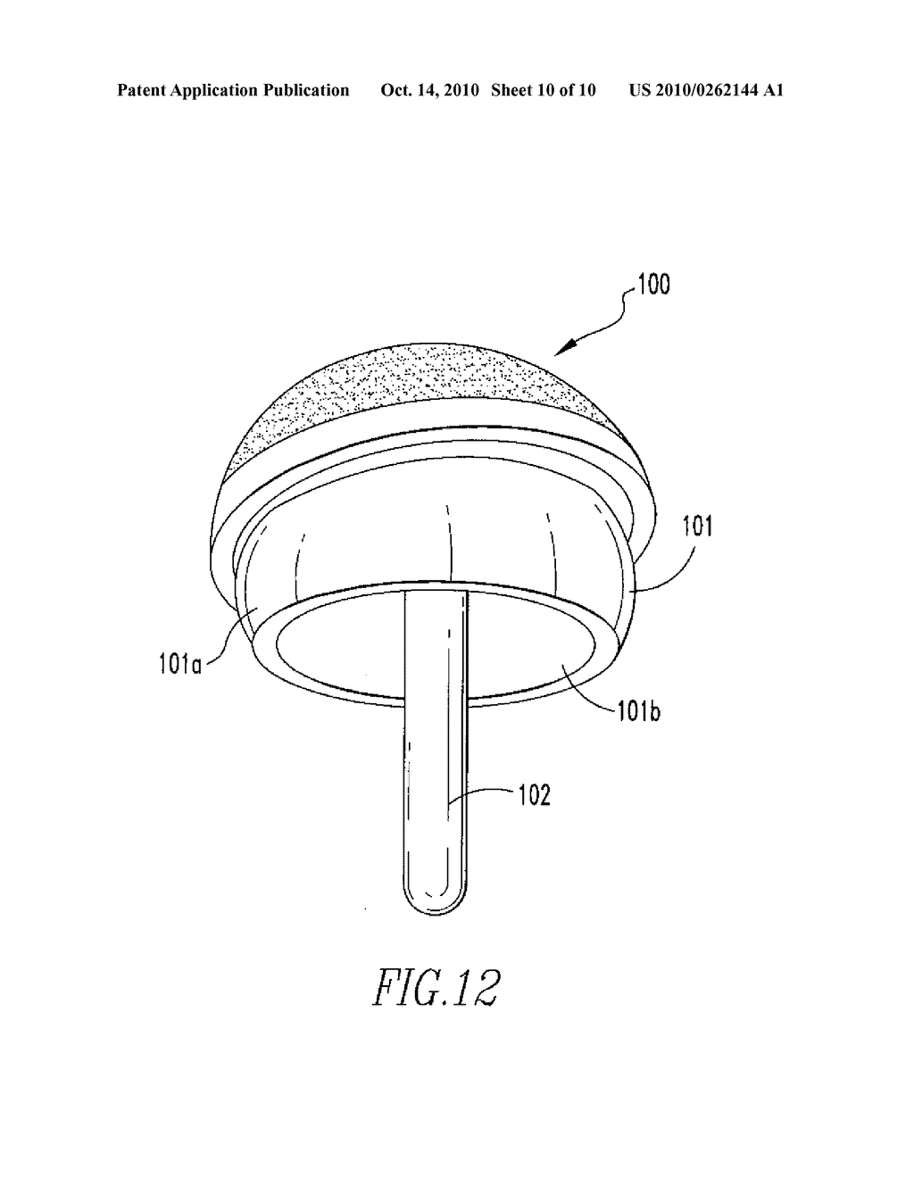 PROSTHETIC IMPLANTS - diagram, schematic, and image 11