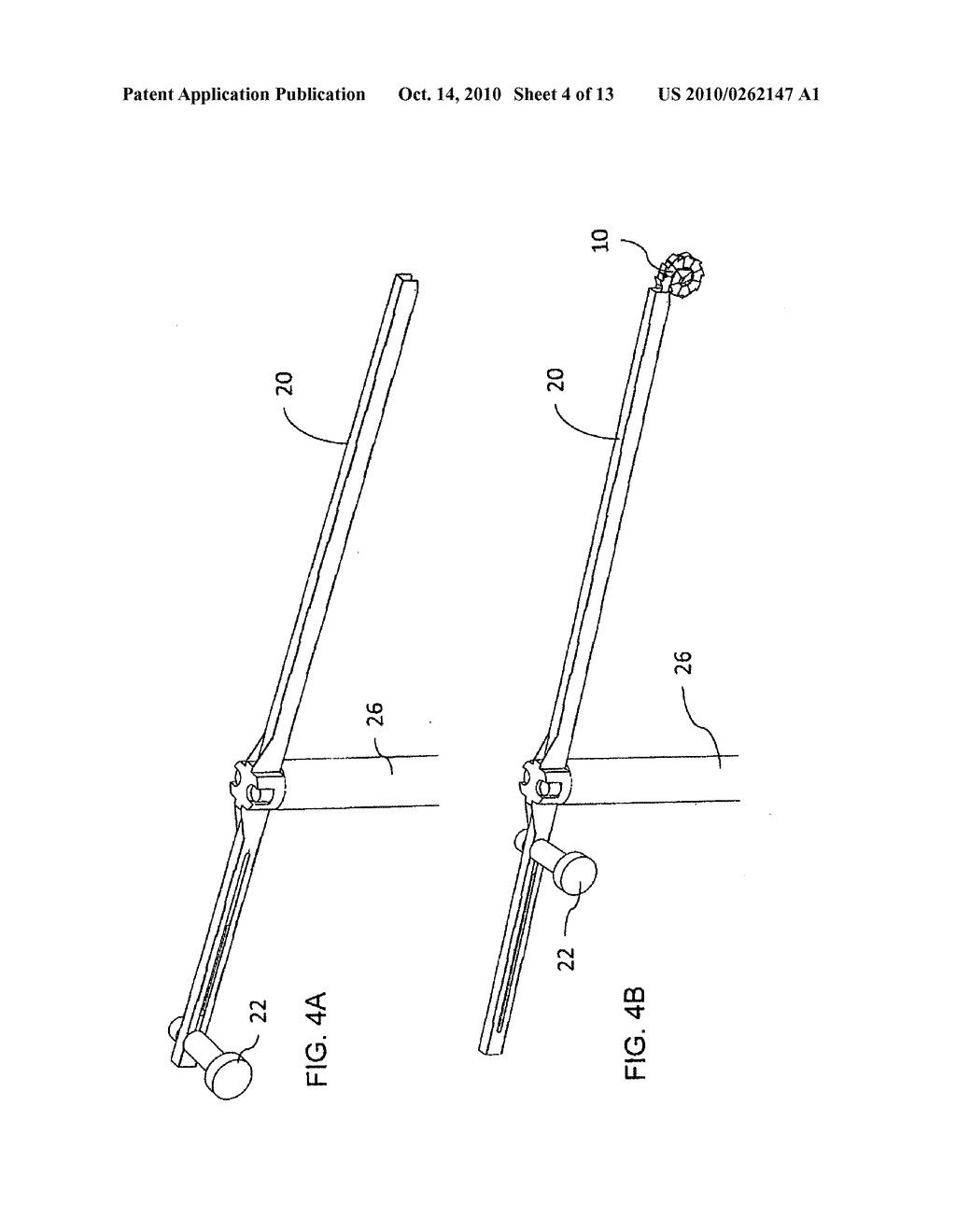 TOOL AND CORRESPONDING METHOD FOR REMOVAL OF MATERIAL FROM WITHIN A BODY - diagram, schematic, and image 05