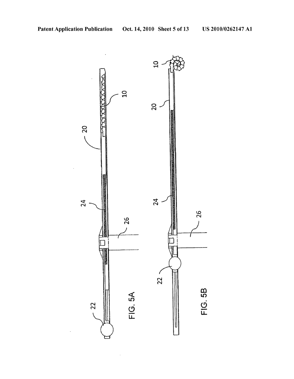TOOL AND CORRESPONDING METHOD FOR REMOVAL OF MATERIAL FROM WITHIN A BODY - diagram, schematic, and image 06