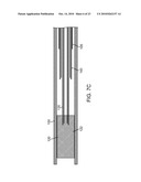 Methods and Systems for Loading a Stent diagram and image