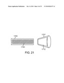 Methods and Systems for Loading a Stent diagram and image