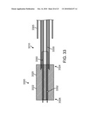 Methods and Systems for Loading a Stent diagram and image