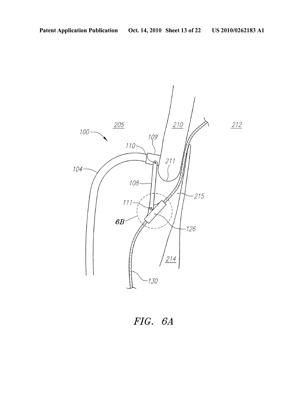 SYSTEMS DEVICES AND METHODS FOR ACHIEVING TRANSVERSE ORIENTATION IN THE TREATMENT OF SEPTAL DEFECTS - diagram, schematic, and image 14