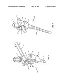 SPINAL ROD TRANSLATION DEVICE diagram and image