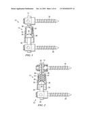 SYSTEMS AND DEVICES FOR DYNAMIC STABILIZATION OF THE SPINE diagram and image