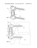 SYSTEMS AND DEVICES FOR DYNAMIC STABILIZATION OF THE SPINE diagram and image