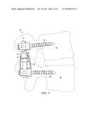 SYSTEMS AND DEVICES FOR DYNAMIC STABILIZATION OF THE SPINE diagram and image