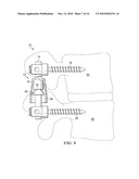 SYSTEMS AND DEVICES FOR DYNAMIC STABILIZATION OF THE SPINE diagram and image