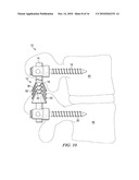 SYSTEMS AND DEVICES FOR DYNAMIC STABILIZATION OF THE SPINE diagram and image