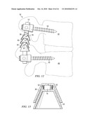 SYSTEMS AND DEVICES FOR DYNAMIC STABILIZATION OF THE SPINE diagram and image
