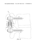 SYSTEMS AND DEVICES FOR DYNAMIC STABILIZATION OF THE SPINE diagram and image