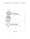 SYSTEMS AND DEVICES FOR DYNAMIC STABILIZATION OF THE SPINE diagram and image