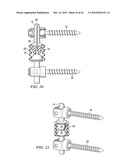 SYSTEMS AND DEVICES FOR DYNAMIC STABILIZATION OF THE SPINE diagram and image