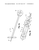 Methods and instrumentation for vertebral interbody fusion diagram and image