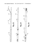 Methods and instrumentation for vertebral interbody fusion diagram and image