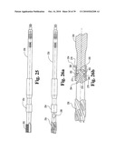 Methods and instrumentation for vertebral interbody fusion diagram and image