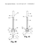 Methods and instrumentation for vertebral interbody fusion diagram and image