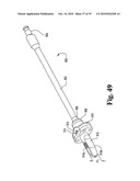 Methods and instrumentation for vertebral interbody fusion diagram and image