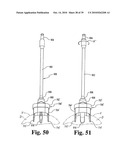 Methods and instrumentation for vertebral interbody fusion diagram and image