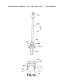 Methods and instrumentation for vertebral interbody fusion diagram and image