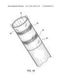 DEVICE AND METHOD FOR TACKING PLAQUE TO A BLOOD VESSEL WALL diagram and image