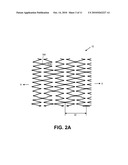 IMPLANTS HAVING HIGH FATIGUE RESISTANCE, IMPLANT DELIVERY SYSTEMS, AND METHODS OF USE diagram and image