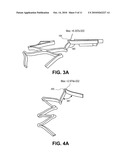 IMPLANTS HAVING HIGH FATIGUE RESISTANCE, IMPLANT DELIVERY SYSTEMS, AND METHODS OF USE diagram and image