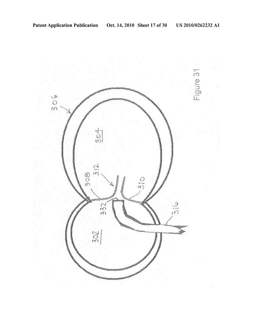 Implantable scaffolding containing an orifice for use with a prosthetic or bio-prosthetic valve - diagram, schematic, and image 18