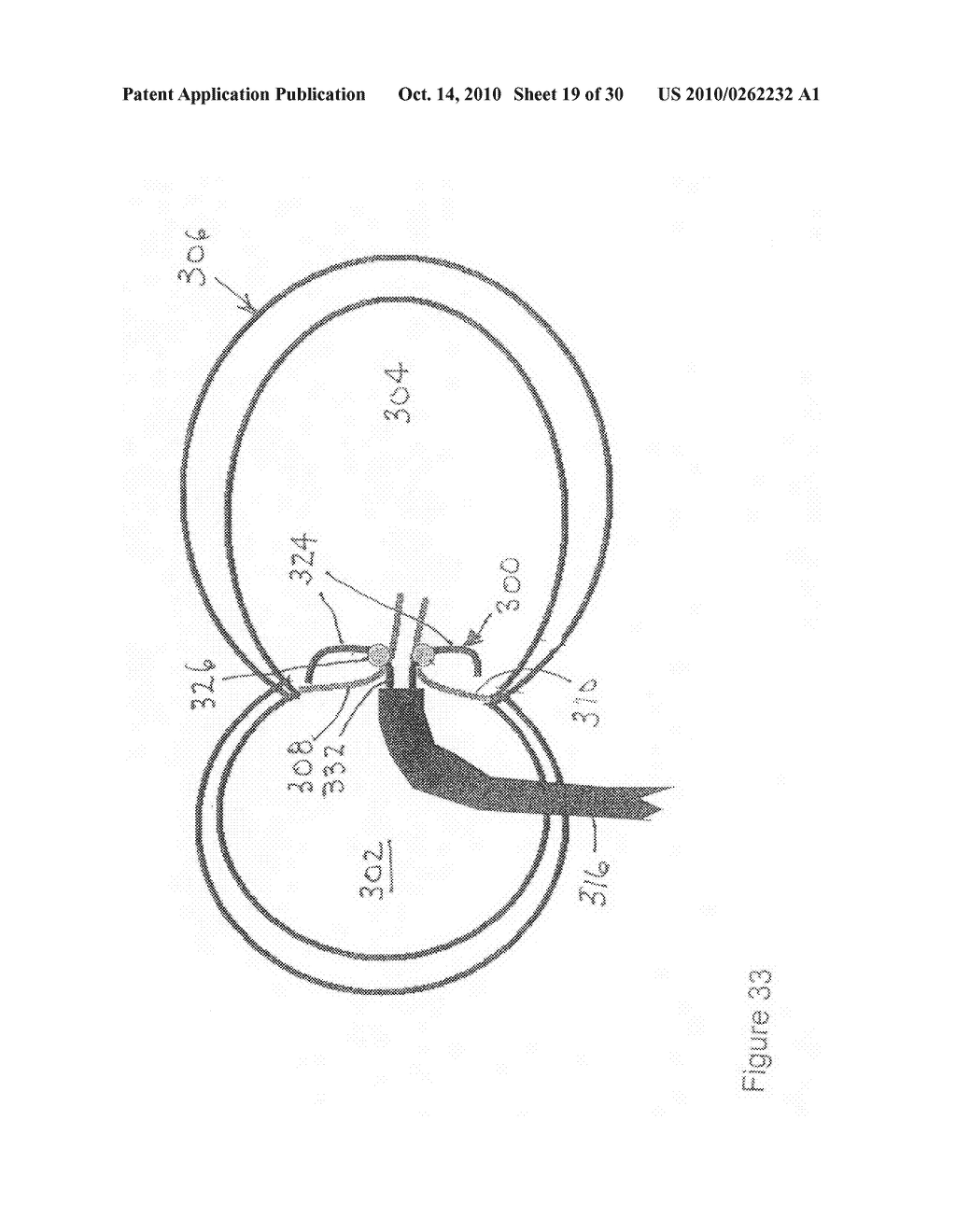 Implantable scaffolding containing an orifice for use with a prosthetic or bio-prosthetic valve - diagram, schematic, and image 20