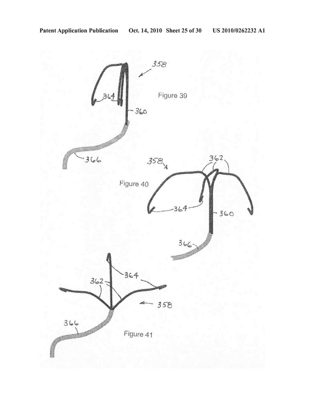 Implantable scaffolding containing an orifice for use with a prosthetic or bio-prosthetic valve - diagram, schematic, and image 26