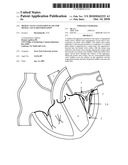 Mitral Valve Coaptation Plate For Mitral Valve Regurgitation diagram and image