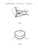 Mitral Valve Coaptation Plate For Mitral Valve Regurgitation diagram and image