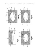 POROUS CONTAINMENT DEVICE AND ASSOCIATED METHOD FOR STABILIZATION OF VERTEBRAL COMPRESSION FRACTURES diagram and image