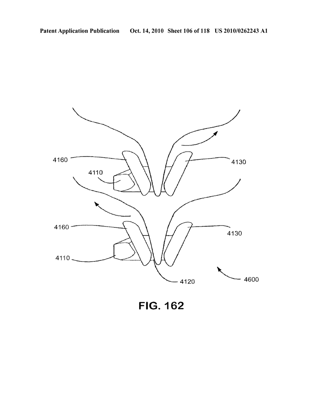 SPINE DISTRACTION IMPLANT - diagram, schematic, and image 108