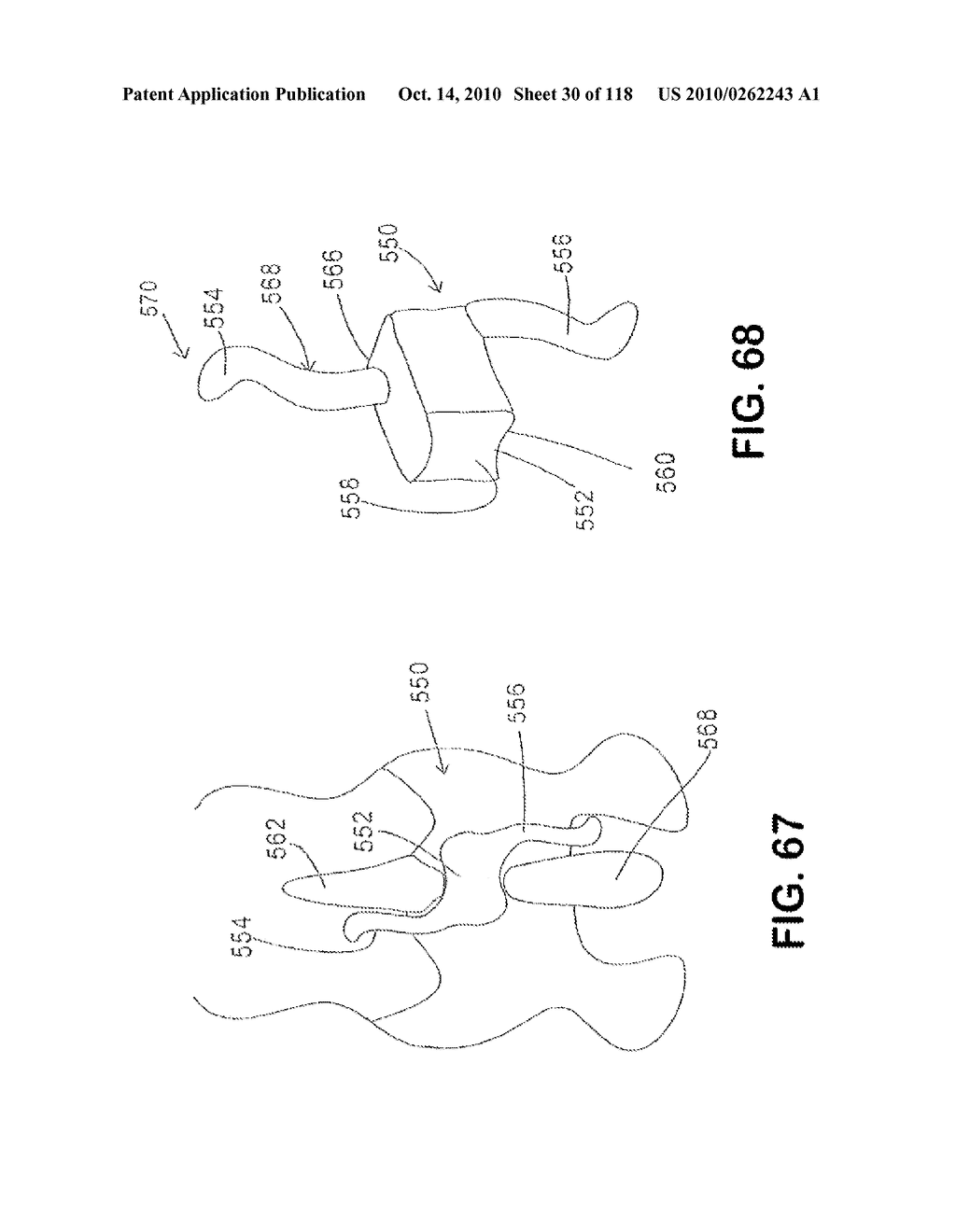 SPINE DISTRACTION IMPLANT - diagram, schematic, and image 32